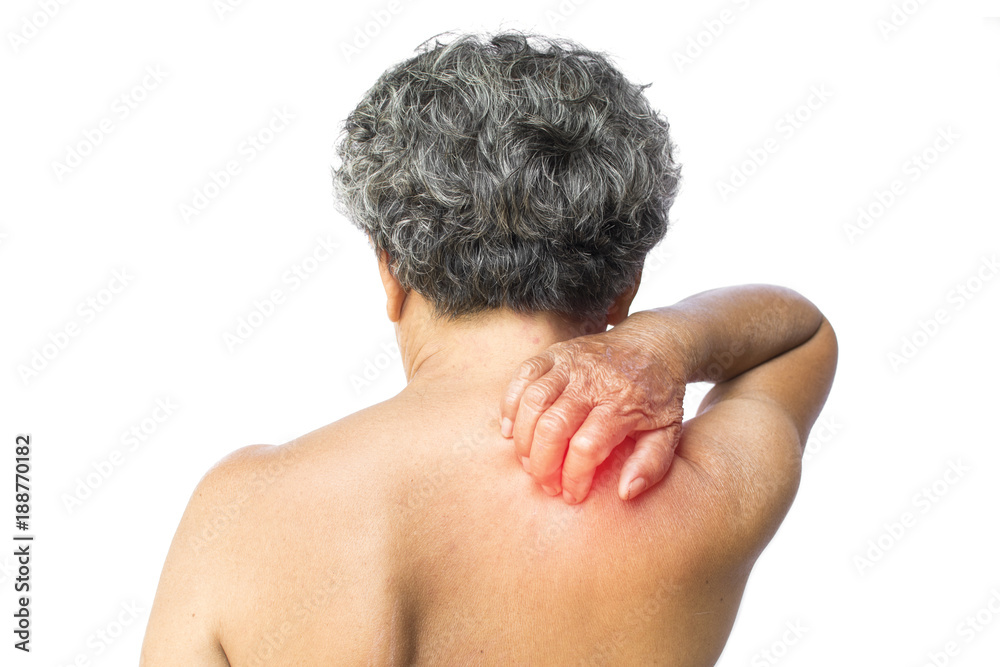 Old woman itching her back on white background,Dermatitis problem concept healthcare Old woman itching her back on white background,Dermatitis problem concept healthcare