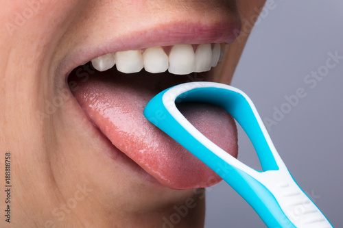 Woman Cleaning Tongue With Cleaner