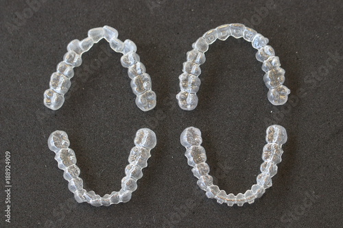 マウスピース矯正