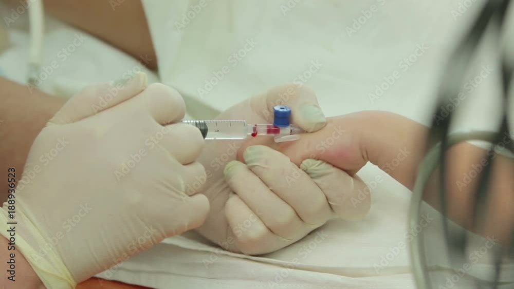 Injection into the child's hand with a syringe, catheter and hands of an anesthetist close-up (1080p, 50fps) Injection into the child's hand with a syringe, catheter and hands of an anesthetist close-up (1080p, 50fps)