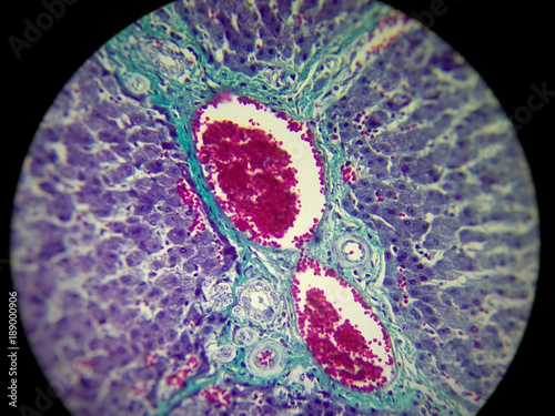 Histological blade of the hepatic portal space in vivid and beautiful colors. Mallory coloring with center focus with a microscope.