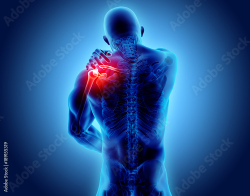 Shoulder painful skeleton x-ray, 3D illustration.
