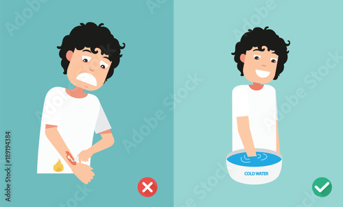 wrong and right ways first aid emergency treatment skin burn,illustration