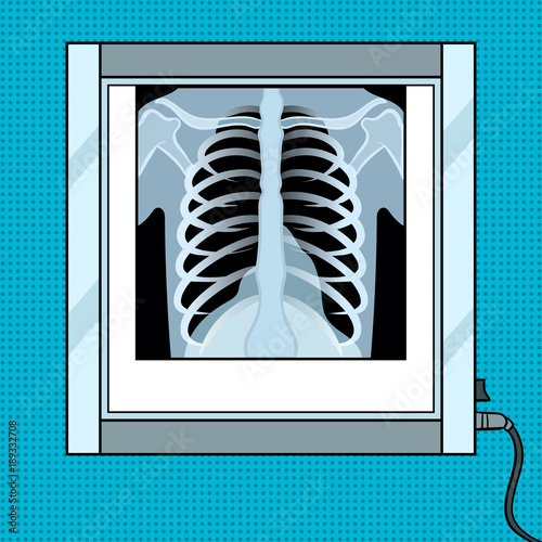 Xray chest in negatoscope pop art vector