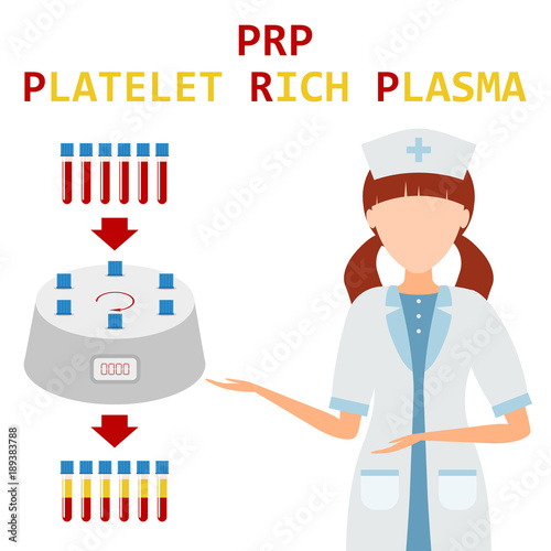 Platelet rich plasma. PRP method. Vector.