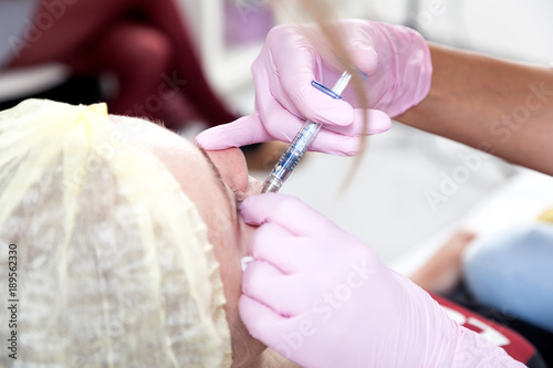 Close-up of a female cosmetician injecting an injection of Botox into the cheekbones of a young woman to correct the shape