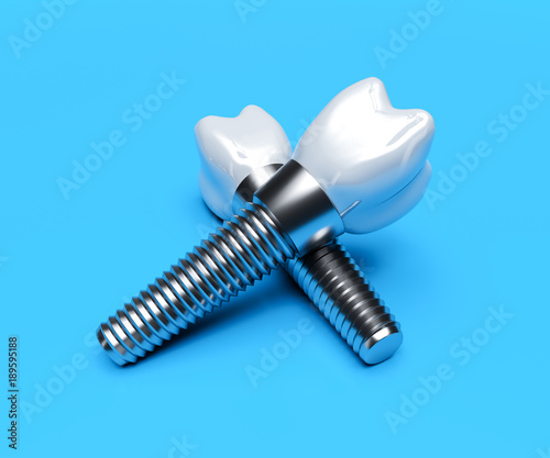 Fototapeta Naklejka Na Ścianę i Meble -  Dental implants