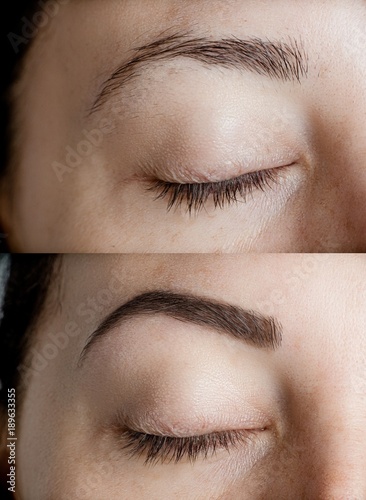 Eyebrows Before After photo