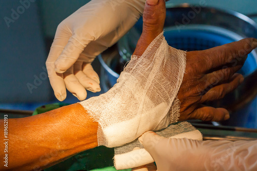 Compression bandage gauze
