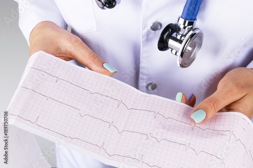 Electrocardiogram, ecg in hand of a female doctor. Medical health care. Clinic cardiology heart rhythm and pulse test closeup. Cardiogram printout. photo