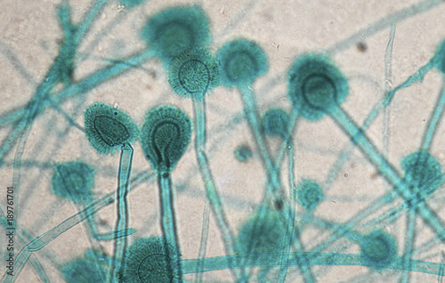 Aspergillus under microscope  photo