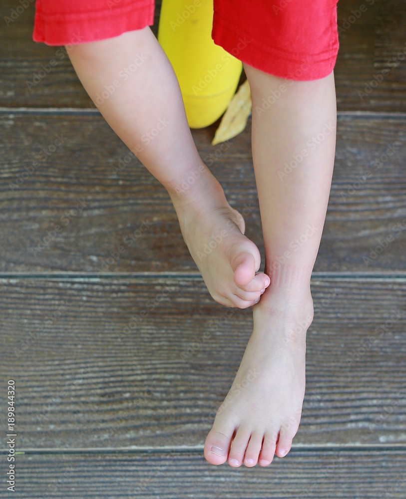 Little girl itchy foot on wood background. Stock Photo Adobe Stock