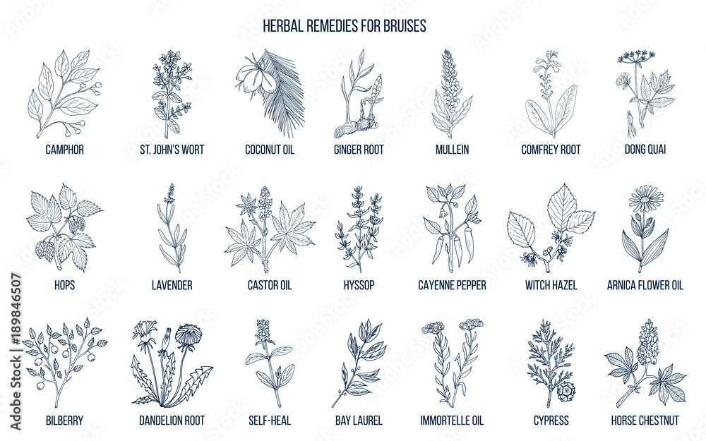Best herbal remedies to treat bruises Best herbal remedies to treat bruises