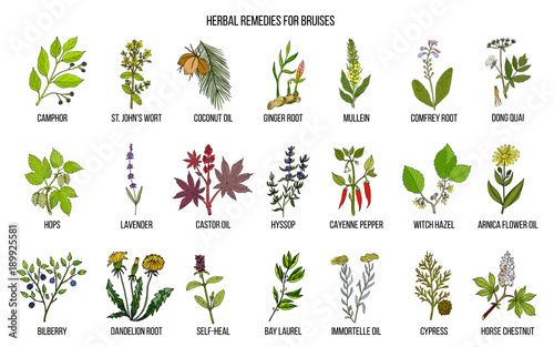 Best herbal remedies to treat bruises
