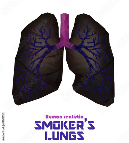 Low poly realistic human lungs and bronchus with cancer inflammation disease. Vector.