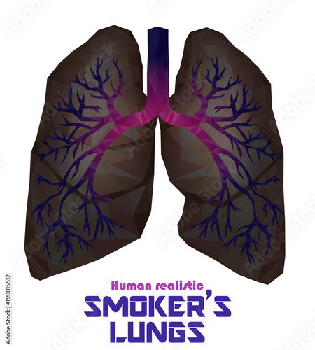 Low poly realistic human lungs and bronchus with cancer inflammation disease. Vector.