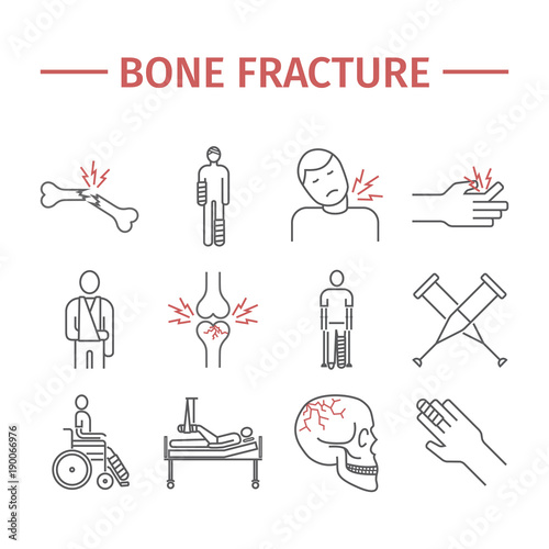 Bone Fractures line icons. Treatment. Infographic. Vector illustrations