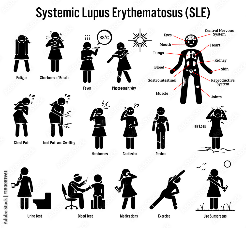 Symptoms lupus