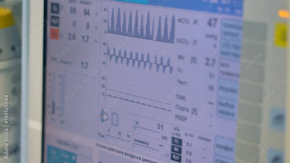 A screen showing patients data from a medical ventilator. A screen showing patients data from a medical ventilator.