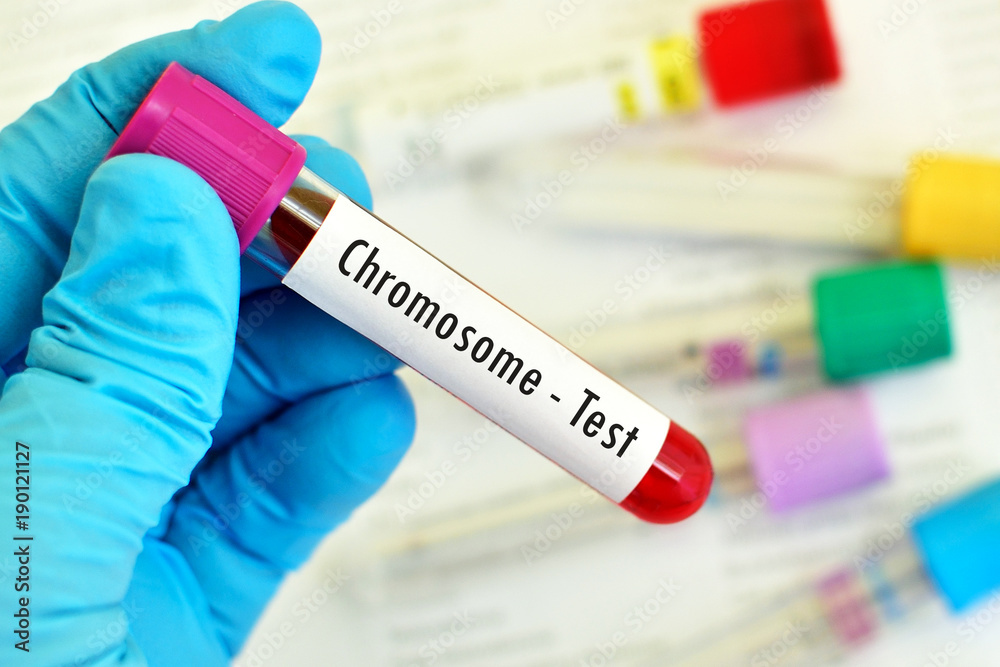 Blood sample for chromosome test
