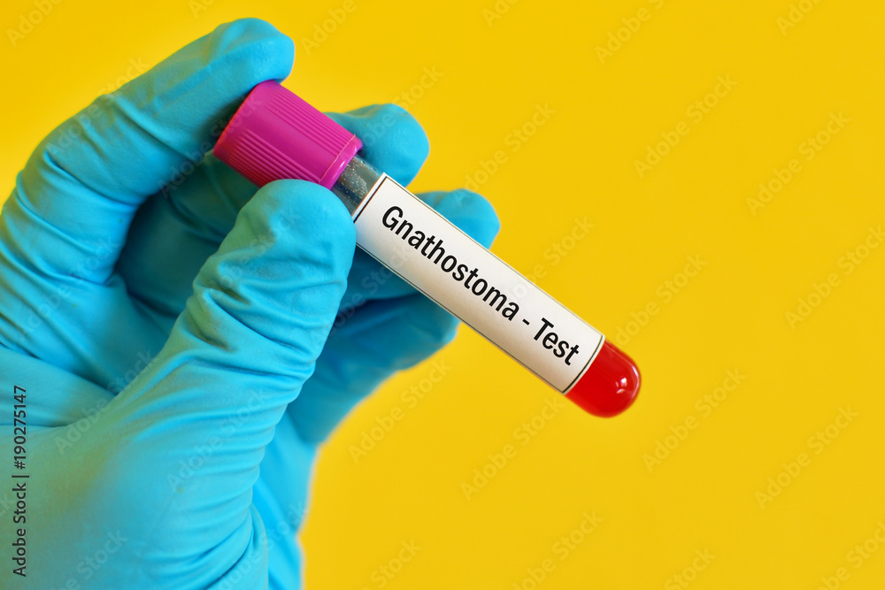 Fototapeta premium Test tube with blood sample for Gnathostoma parasite test