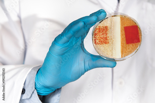 doctor holding plate with Growth of colonies of bacteria in culture medium / technician holding plate with bacterial colonies in the laboratory photo