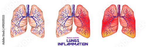 Human lungs and trachea set in low poly. Healthy, one lung ill, sick lungs.  Vector.