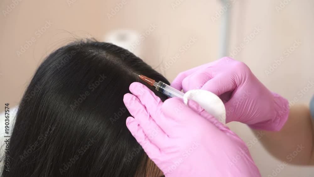 Woman receives an injection in the scalp. Problems of hair loss The concept of health. Woman receives an injection in the scalp. Problems of hair loss The concept of health.