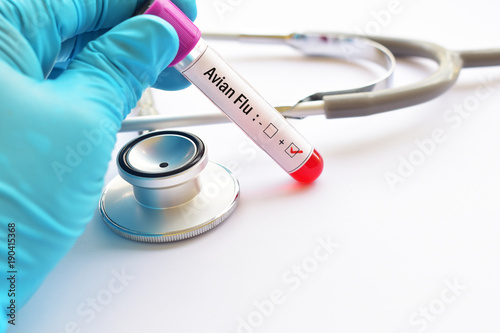 Blood sample tube positive with Avian influenza virus