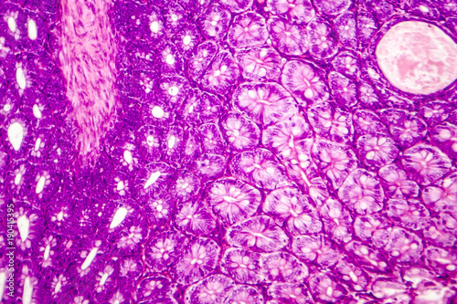 Histology of human appendix, micrograph showing Crypts of Lieberkuhn. Photo under microscope photo