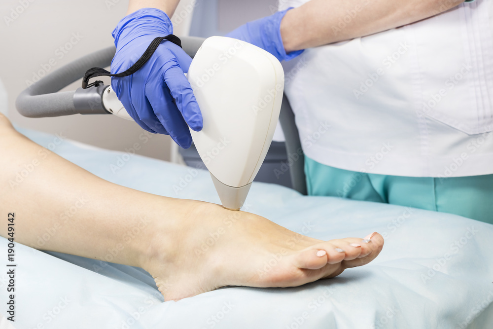 The process of laser depilation of female limbs in the beauty salon The process of laser depilation of female limbs in the beauty salon