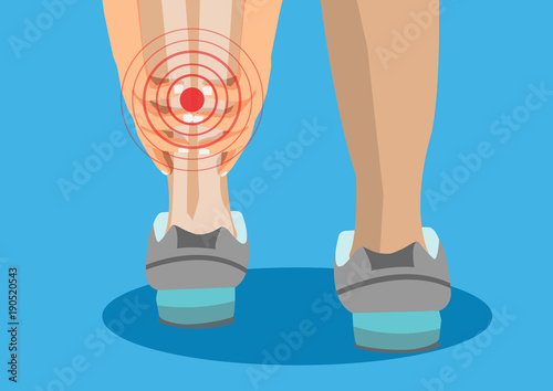 Woman running in the park injury and muscle cramp, cartoon flat-style vector illustration.