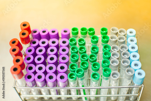 Colorful background a rack of color tubes with blood samples other patients / laboratory technician