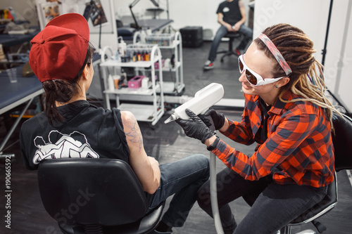 laser tattoo removal from arm