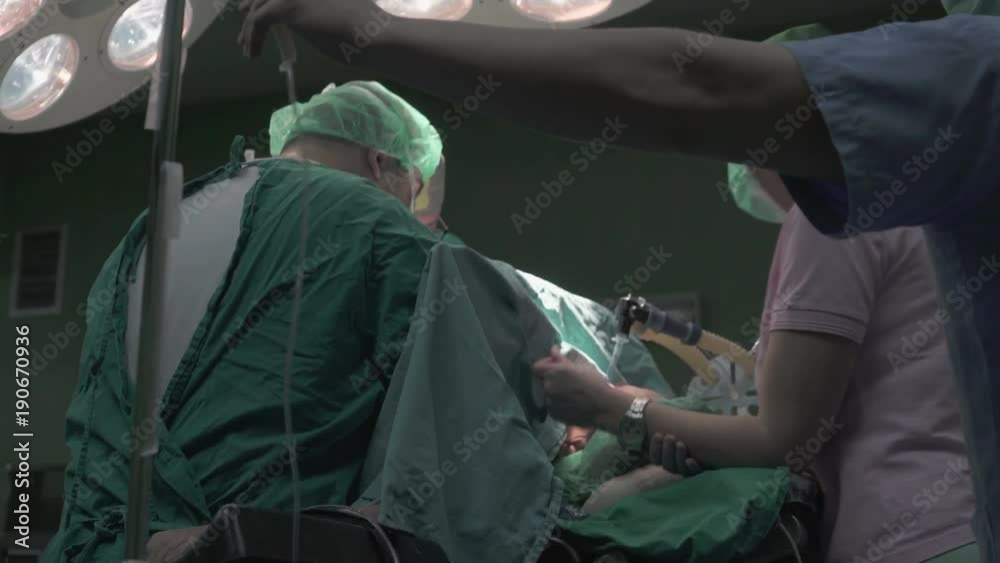 Active scene of surgery operation in operating room, a team of surgeons using surgical tools to