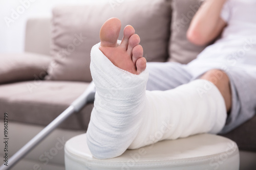 Man's Plastered Leg