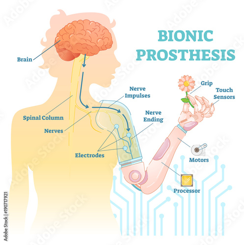 Bionic prosthesis - robotic female hand 