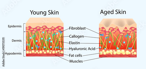 Vector diagram with schemes of two types of skin, for healthcare illustrations photo