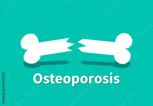 Osteoporosis, Broken bone in vector design