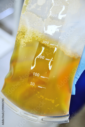 Canvastavla plasma in a plastic bag in the hands of a nurse