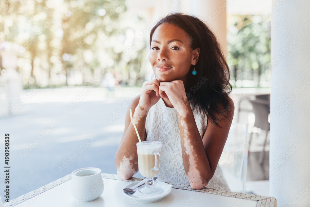 Beautiful african girl with skin problems and sits in a cafe for a cup of hot tea Beautiful african girl with skin problems and sits in a cafe for a cup of hot tea