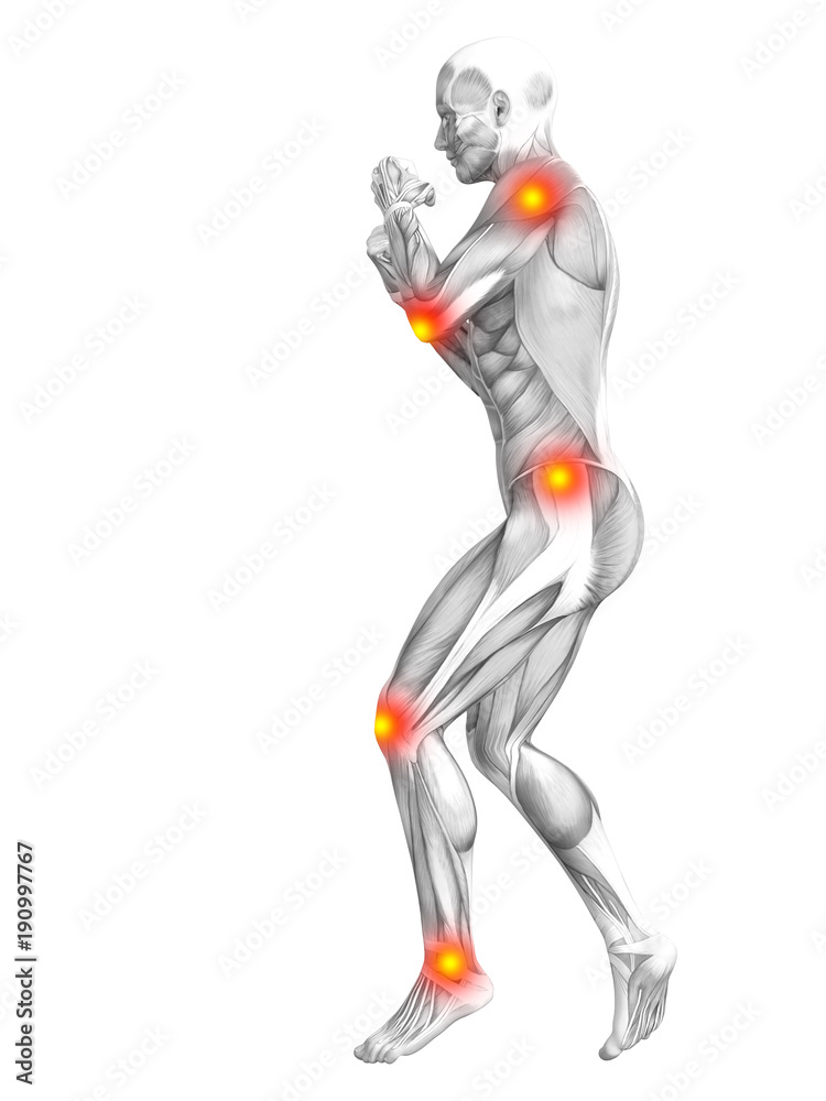 Conceptual human muscle anatomy with red and yellow hot spot inflammation or articular joint pain for health care therapy or sport concepts. 3D illustration man arthritis or bone osteoporosis disease Conceptual human muscle anatomy with red and yellow hot spot inflammation or articular joint pain for health care therapy or sport concepts. 3D illustration man arthritis or bone osteoporosis disease