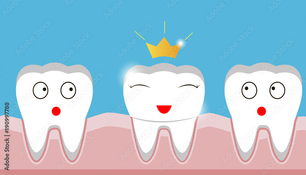 Obraz premium gold crown on tooth, inset, teeth, protection, prosthesis 