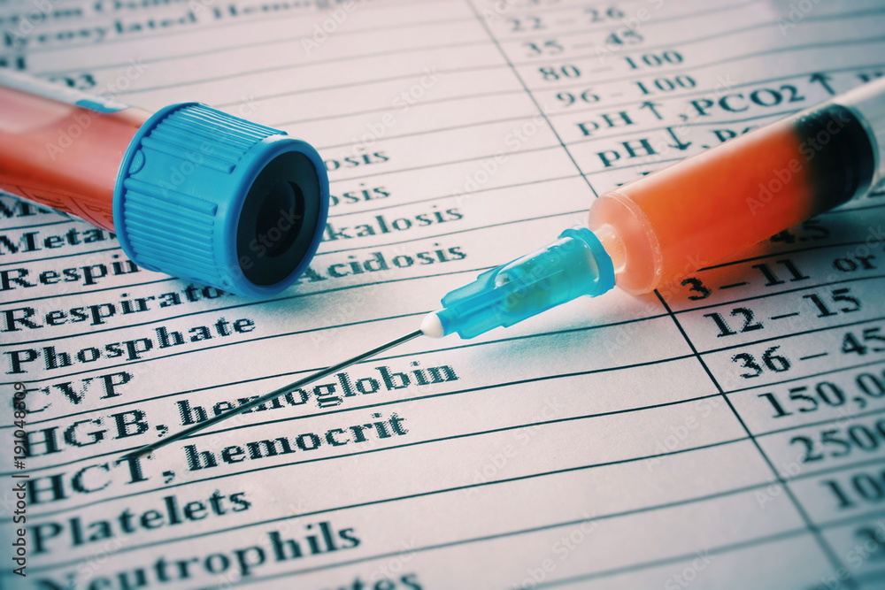 Syringe And Plastic Test Tube With Blood Syringe And Plastic Test Tube With Blood