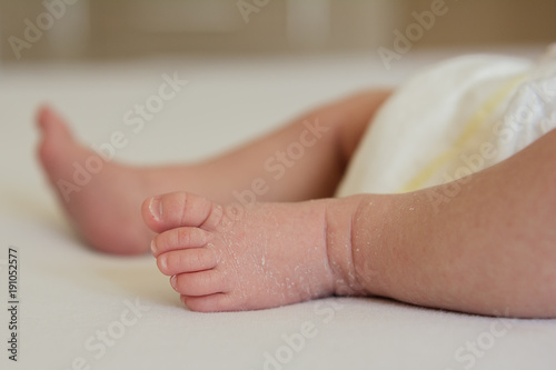 baby newborn feet dry skin 