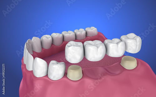 Transparent teeth scan, xray view . 3D illustration .