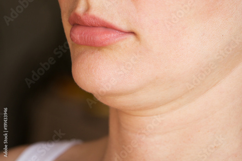face line correction. a woman with a second chin photo