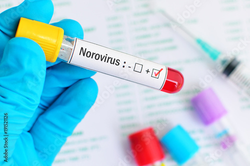 Blood sample positive with Norovirus
 photo