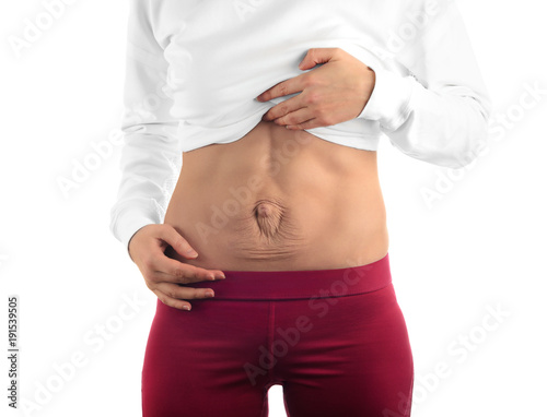 Diastasis recti. Woman's abdomen divergence of the muscles of the abdomen after pregnancy and childbirth. photo