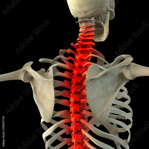 Skeletal back pain isolated on black